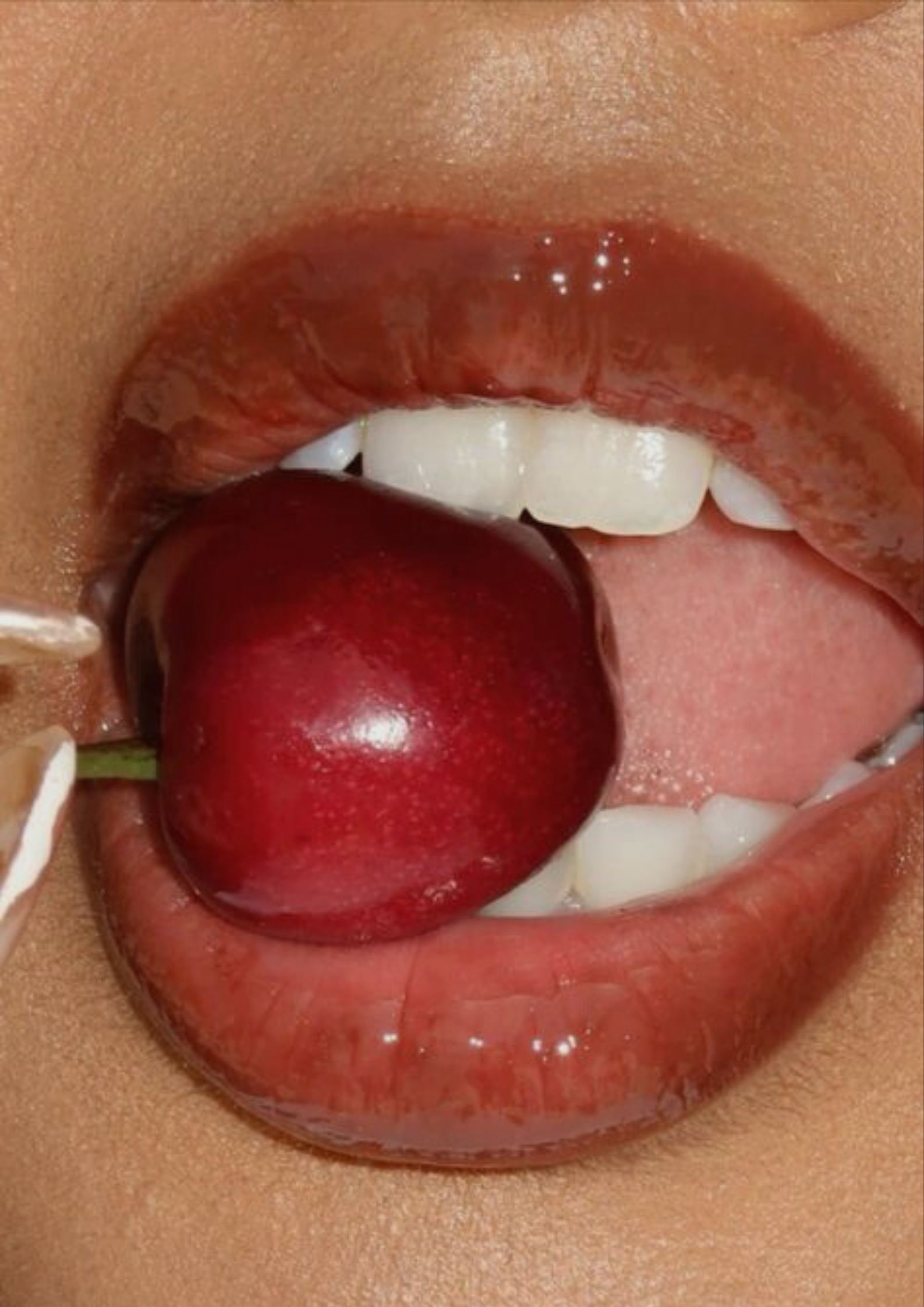 Teeth Whitening